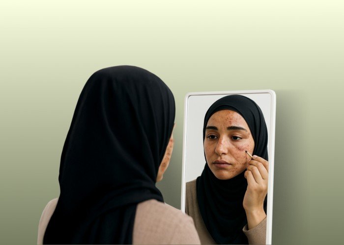 على خارطة أجسادهن ندوب لا تُمحى