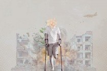 بتر الأطراف: إرث الحرب الأشد ألماً