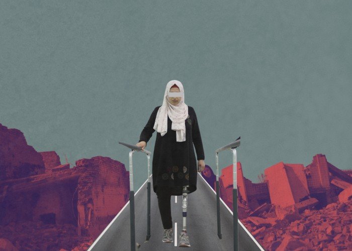 مبتورو الأطراف: حلم قطع السنتيمترات دون مساعدة